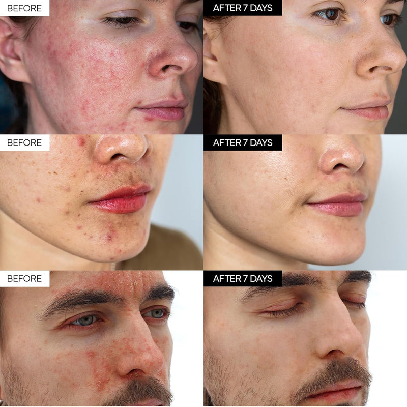 ivoskin - Intensive Cica Repair Cream